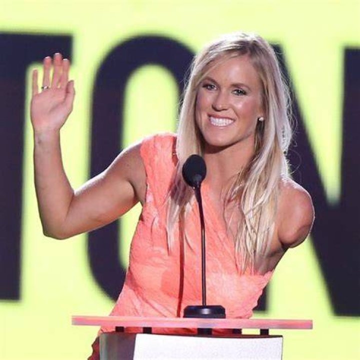 40 Celebrities You Didn’t Know Were Amputees