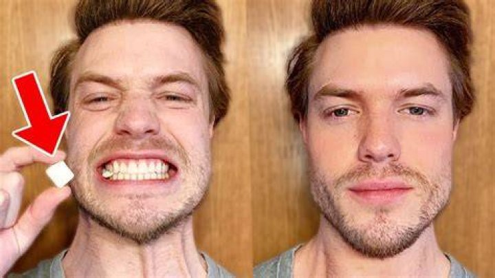 A Doctor Explains Whether or Not Those 'Jaw Trainers' for Men Actually Work