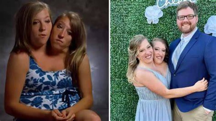 Abby And Brittany Hensel: Sad News 2024