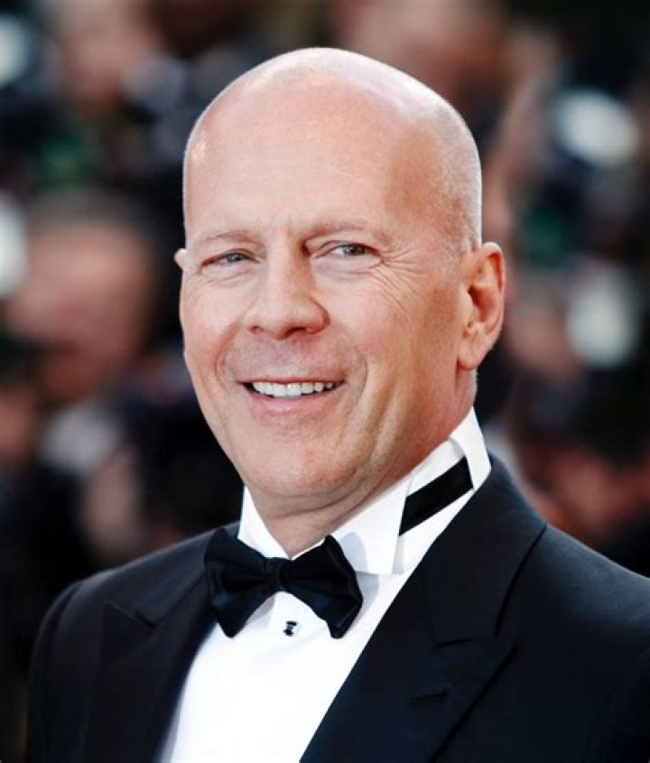Bald Actors: Celebrating The Iconic Stars Who Rock The Look