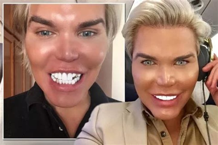 Brazilian Human Ken Doll Dies at 21