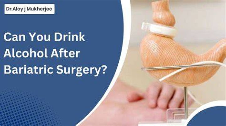 Can I Drink Alcohol After Kidney Stone Surgery