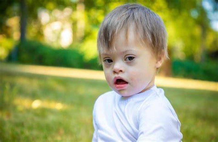 Celebrity Child With Down Syndrome Clooney's Inspiring Story