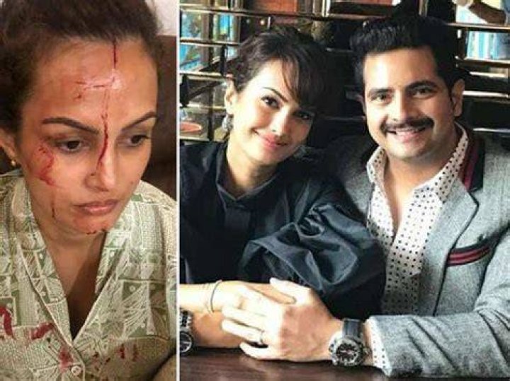 Designer Rohit Verma shares shocking proof of Nisha Rawal’s assault by Karan Mehra