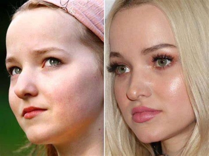 Dove Cameron, Before and After Dove cameron, Blonde actresses