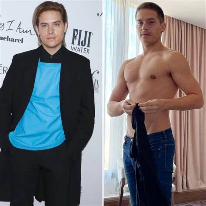 Dylan Sprouse Chest: The Transformation Of A Child Star