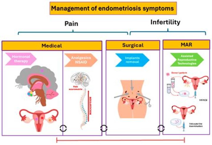 Endometriosis and Ozempic: Understanding the Connection and Treatment Options
