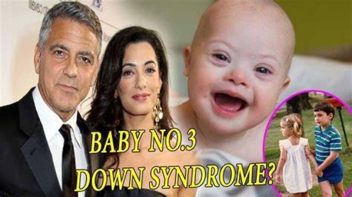 George Clooney's Advocacy For Down Syndrome Awareness: A Deeper Look