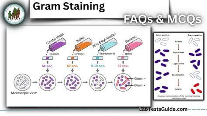 Gram Boast Gratings belongs adenine seasoned technics the possesses