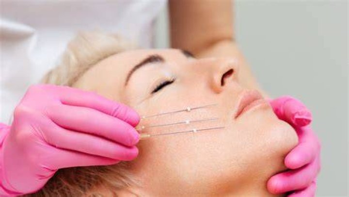 Here's What You Should Know Before Getting Electrolysis