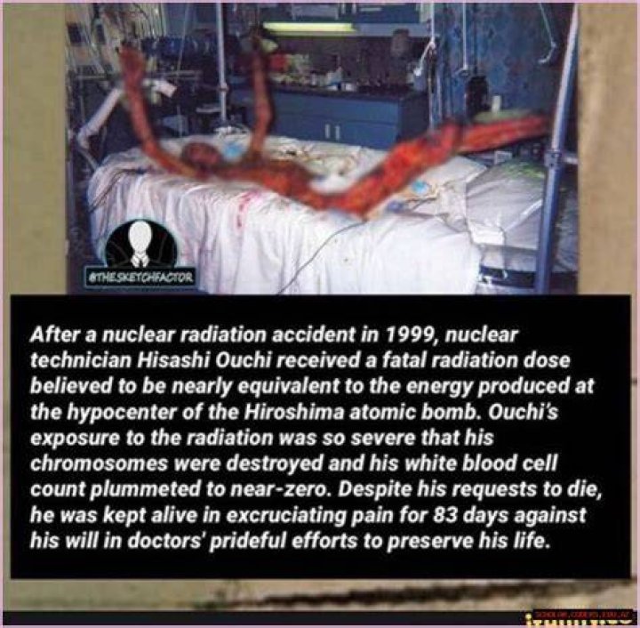 Hisashi Ouchi Real Photos: A Deep Dive Into The Life Of A Nuclear Accident Survivor