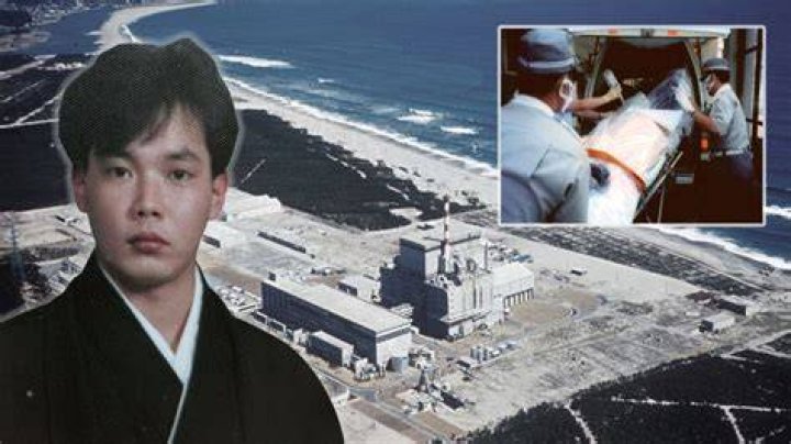 Hisashi Ouchi: The Real Photos And Tragic Story Behind The Incident