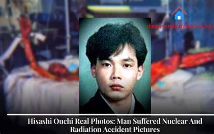 Hisashi Ouchi: The Real Story Behind The Tragic Incident