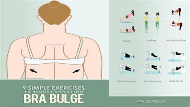 How to Get Rid of Bra Bulge
