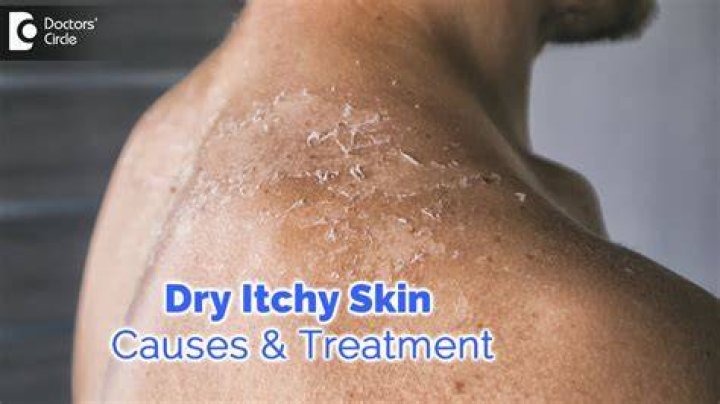 How to Treat Dry, Itchy Skin on Your Junk