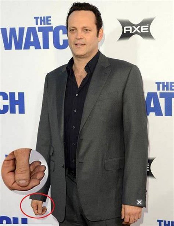 How Vince Vaughn Lost Part Of His Thumb