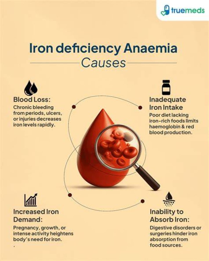 Iron Deficiency in Men Iron deficiency causes