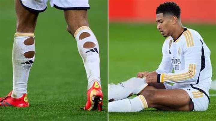 Jude Bellingham Spotted Cutting Holes in His Socks Before Real Madrid’s Win Over Granada