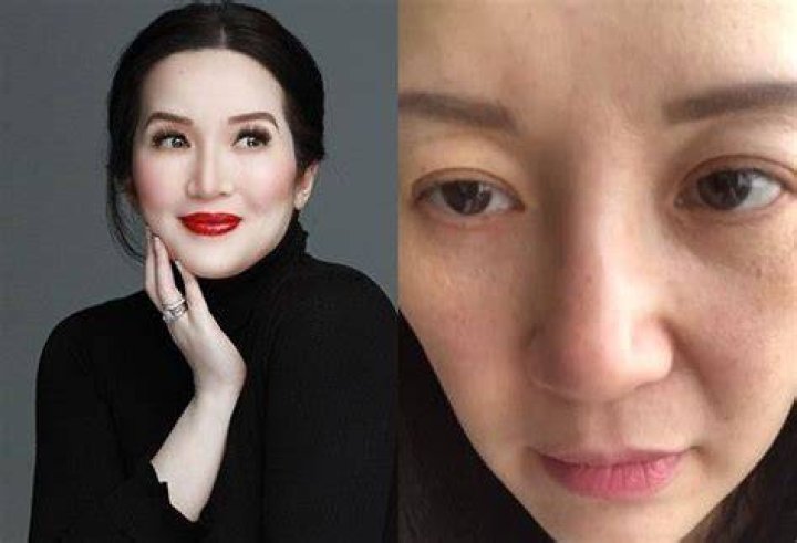 Kris Aquino diagnosed with rare disease EGPA, says goodbye to fans 'for