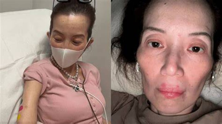 Kris Aquino Disease Health Struggle Unveiled 2024!