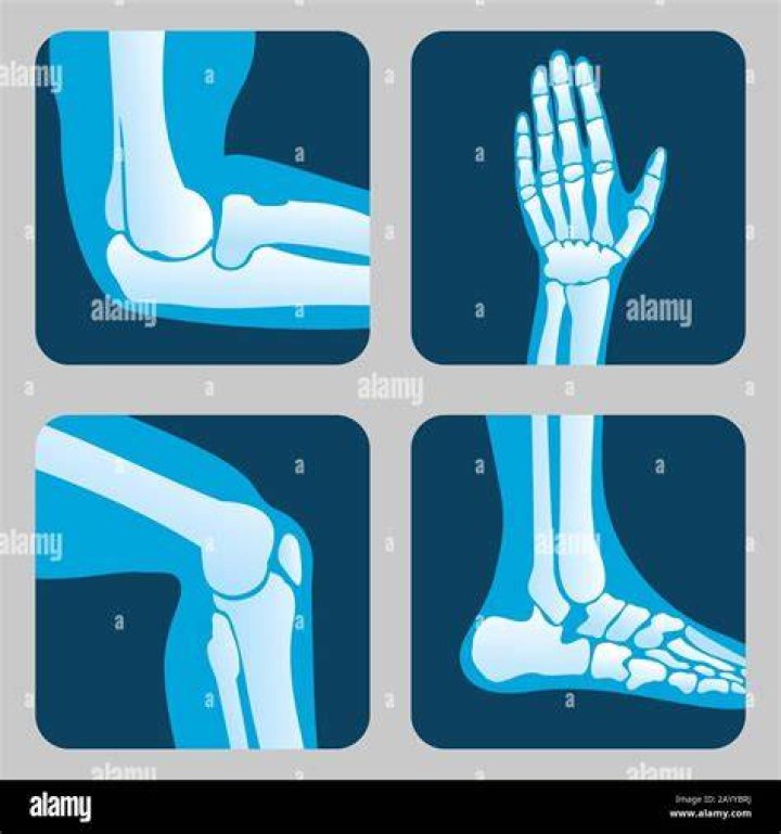 leg, human leg, wrist, elbow, shoulder, physical fitness, joint, standing, knee, thigh,