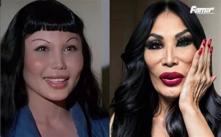 Lyn May Antes Y Despues