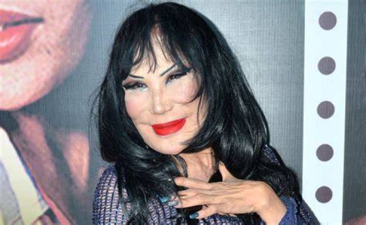 Lyn May el uso del botox con su nuevo rostro &iexcl;Las redes