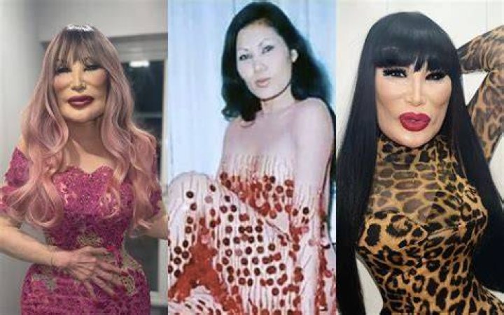 Lyn May invites her fans to &ldquo;get pretty&rdquo; with botox and publishes a