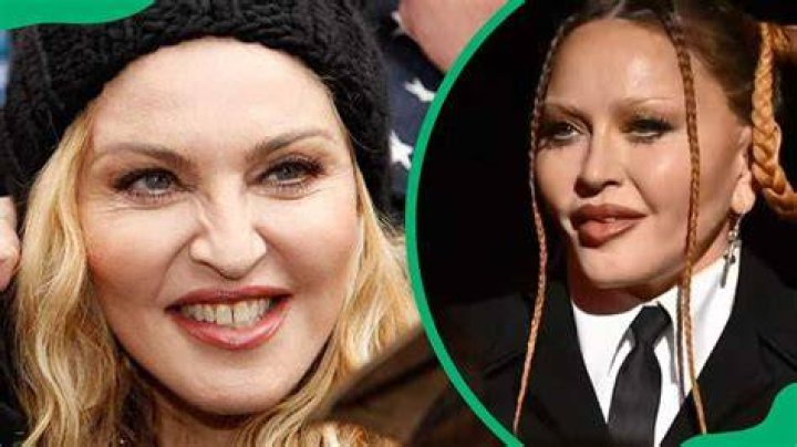 Madonna's plastic surgery: Timeline, experts' analysis, and photos