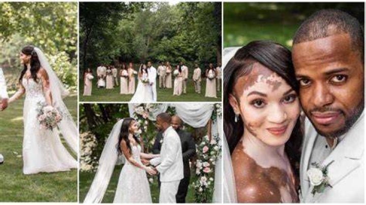 Massive Reactions as Man Ties the Knot to Lady With Vitiligo, He Shares Wedding Photos