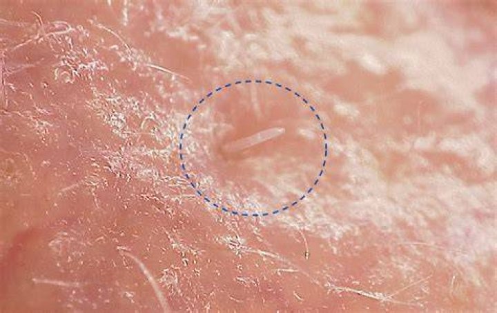 mite
