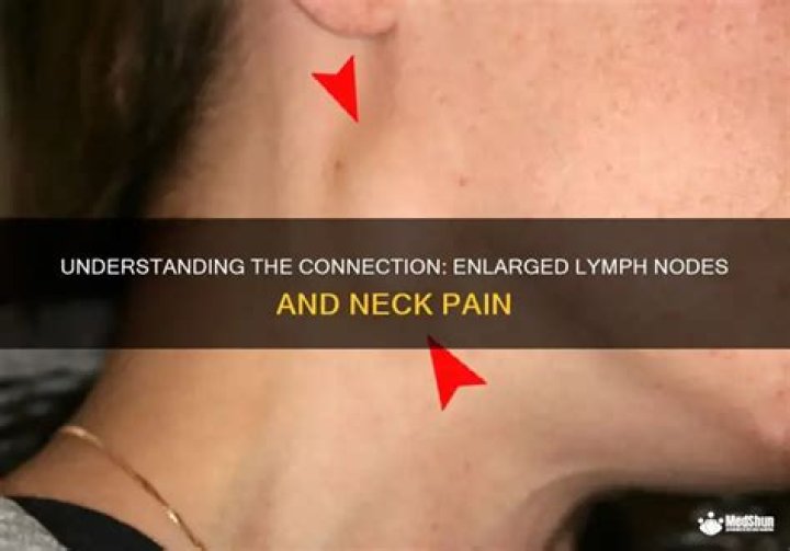 Mounjaro and Lymph Nodes: Understanding the Connection and Treatment Options
