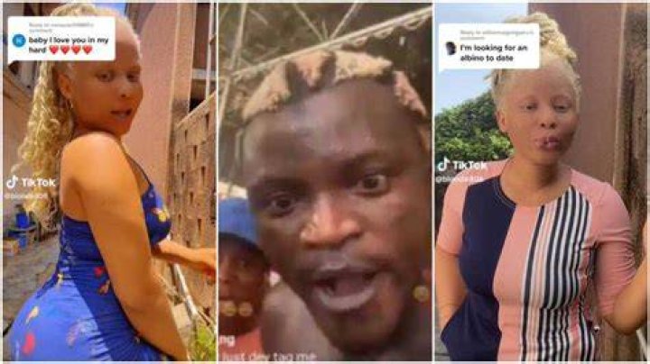 Pretty Lady With Albinism And Perfect Skin Dances to Portable’s 'I’m a Baboon', Gets Men’s Attention