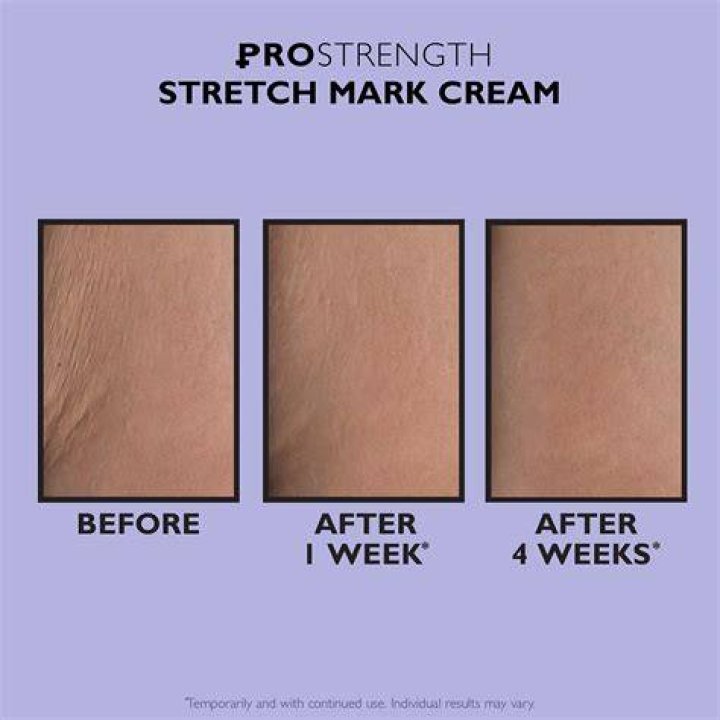 PRO Strength Stretch Mark Cream
