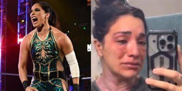 Raquel Rodriguez Shares Video Showing The Physical Toll Of Mast Cell Activation Syndrome