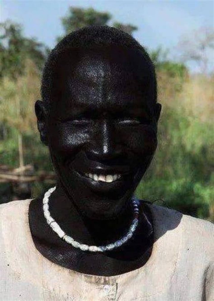 The Blackest Person: A Journey Into The Deepest Shades Of Melanin