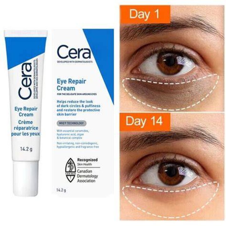 The Eye Cream You Need To Get Rid Of Dark Circles