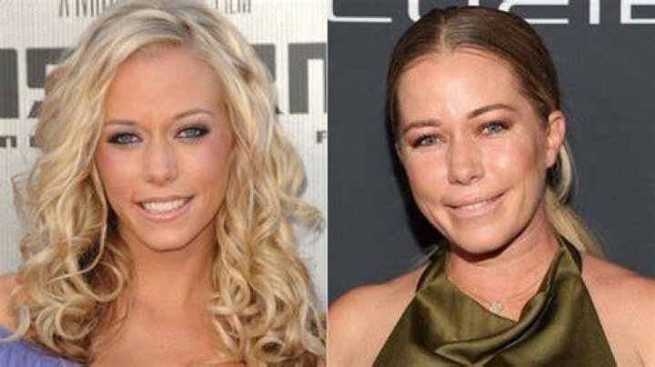 The Stunning Transformation Of Kendra Wilkinson
