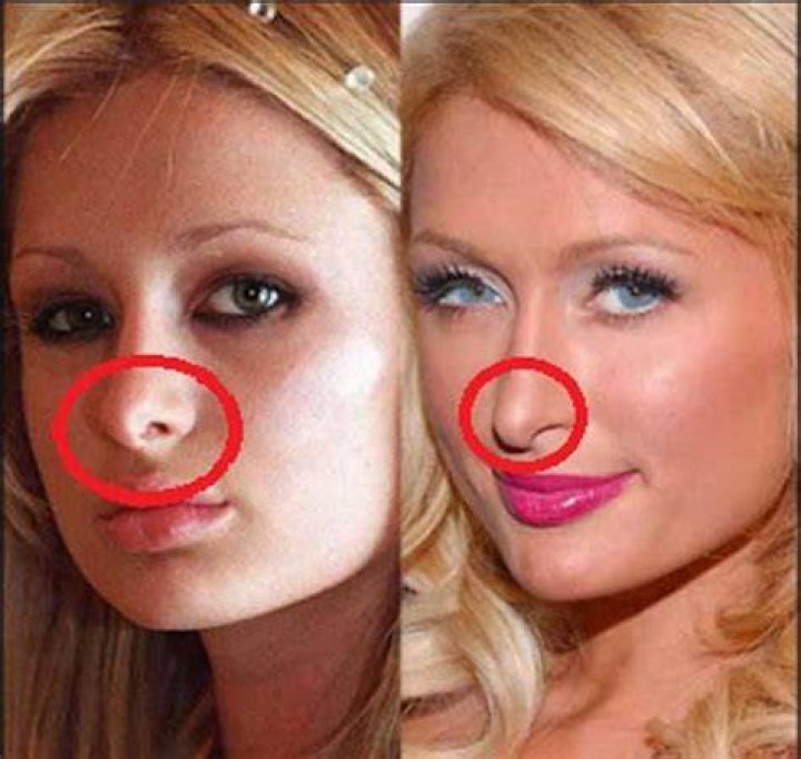 The Ultimate Guide To Paris Hilton's Nose Surgery: Before And After