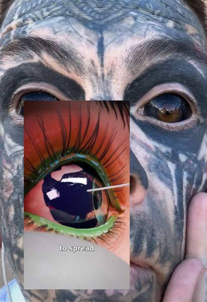 TikToker Quest Gulliford Gets His Eyeballs Tattooed in $10K Procedure