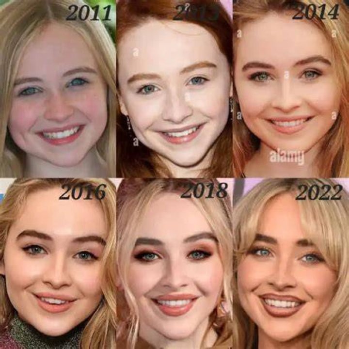Transformations And Revelations: The Sabrina Carpenter Face Change