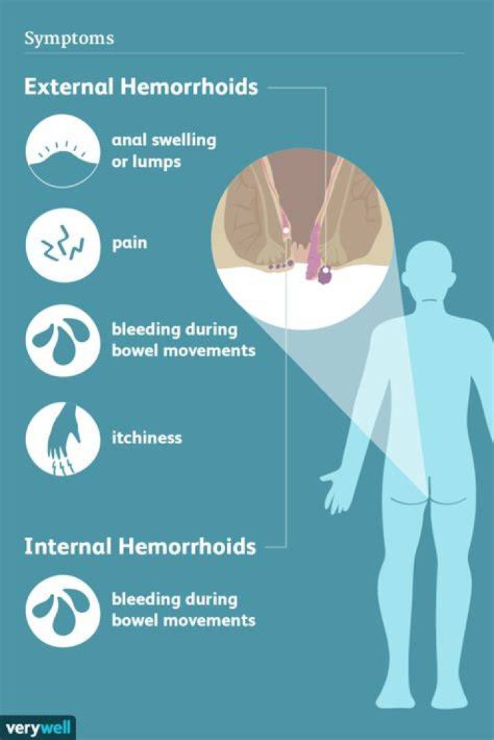 Understanding Hemorrhoids In Dogs: Causes, Symptoms, And Treatment