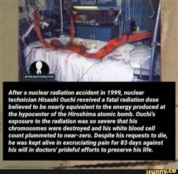 Understanding Ouchi Radiation A Comprehensive Guide