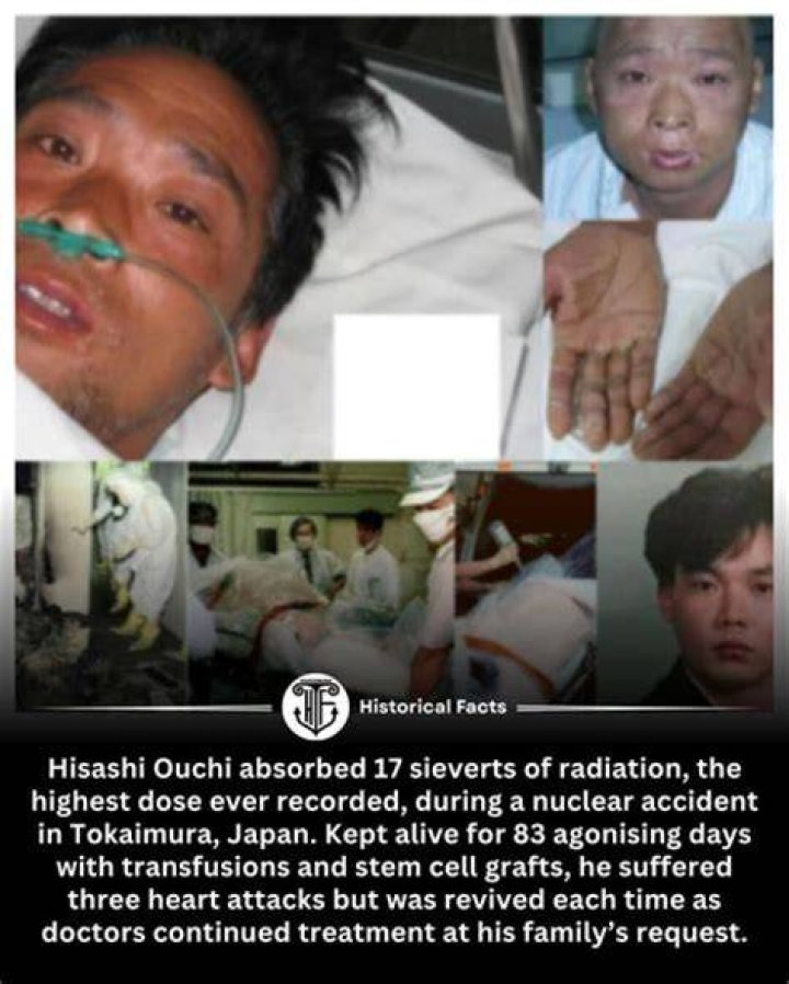 Understanding The Tragic Death Of Hisashi Ouchi: A Deep Dive