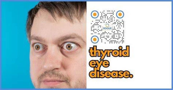 Understanding Thyroid Eye Disease Through Images