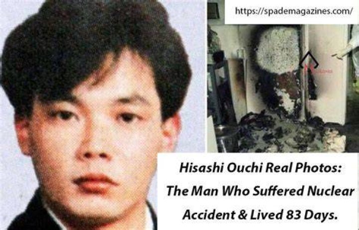 Unveiling The Journey: Hisashi Real Photos Day 80