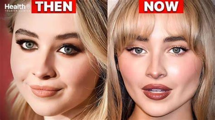 Unveiling The Truth: Did Sabrina Carpenter Get Plastic Surgery?