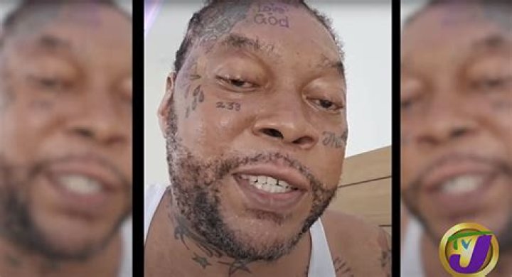 Vybz Kartel and Graves disease Here&rsquo;s what to know Our Today