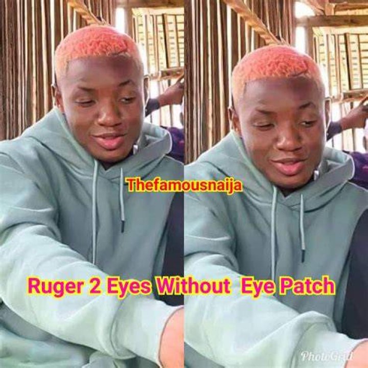 What Happened To Ruger Eye? Is Ruger Blind? Fluentreport