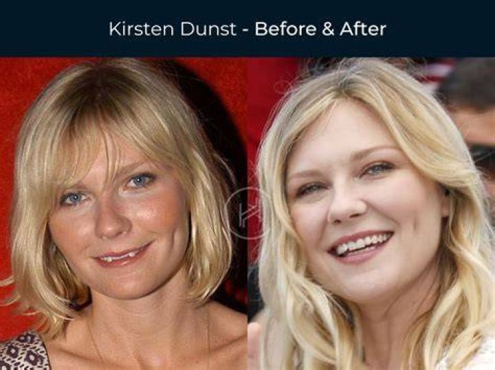 What Plastic Surgery Has Kirsten Vangsness Gotten? Body Measurements